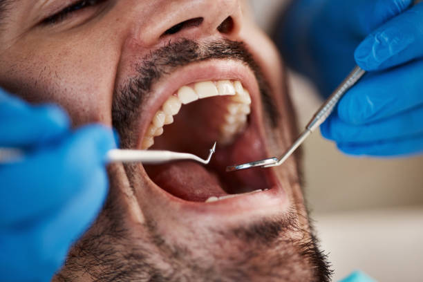 Best Pediatric Emergency Dentist in Parksdale, CA