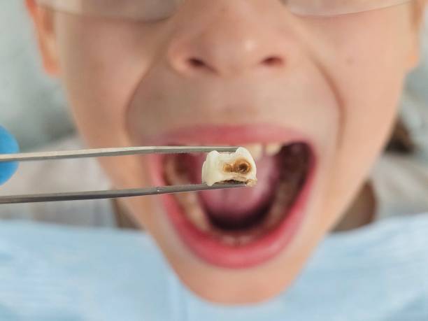 Best After-Hours Emergency Dentist in Parksdale, CA